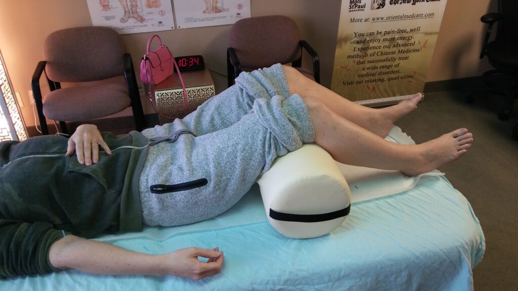 acid reflux acupuncture treatment