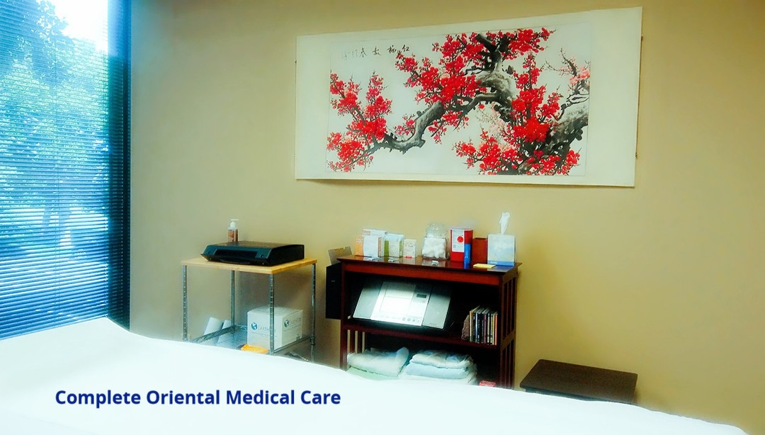 Acupuncture for vertigo and dizziness in Edina, MN