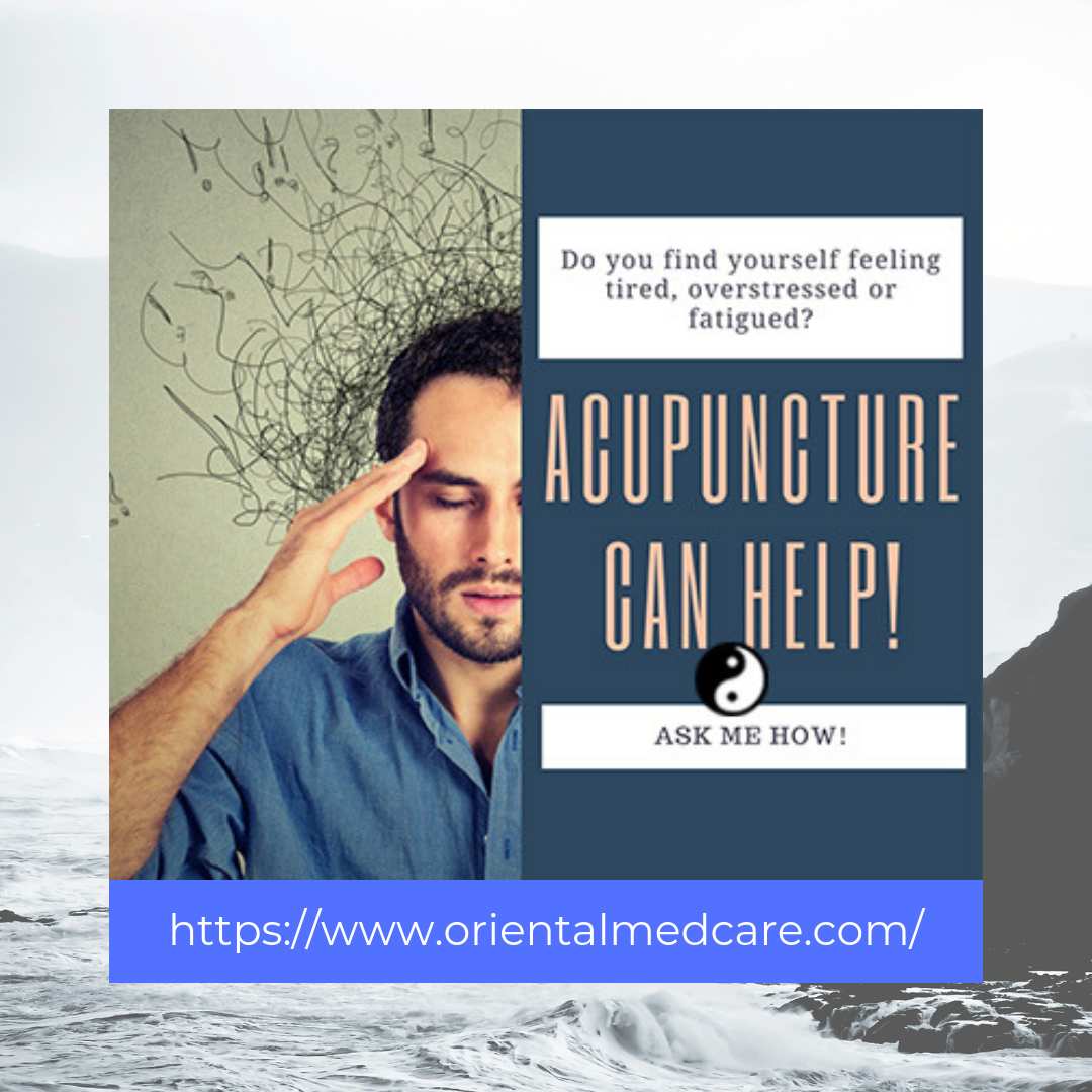 stress relief with acupuncture