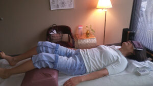 acupuncture treatment