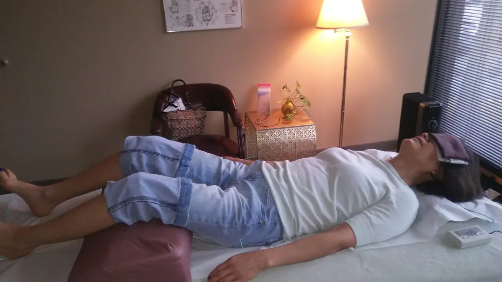 Targeted acupuncture therapy for nervous system regulation.